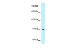 CCDC102B Antibody, Novus Biologicals 100 &mu;L; Unconjugated:Antibodies,